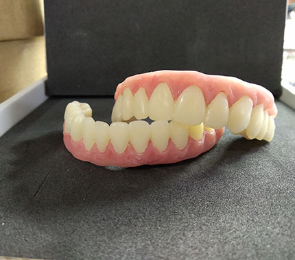 estudio protesico dental casos