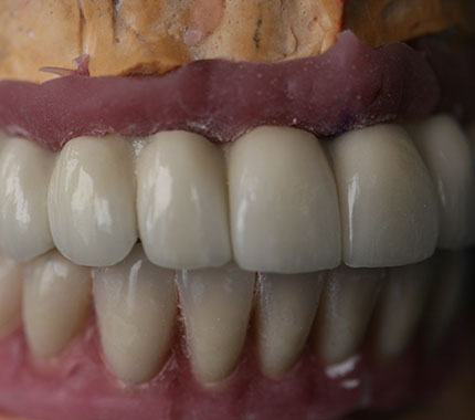 estudio protesico dental casos